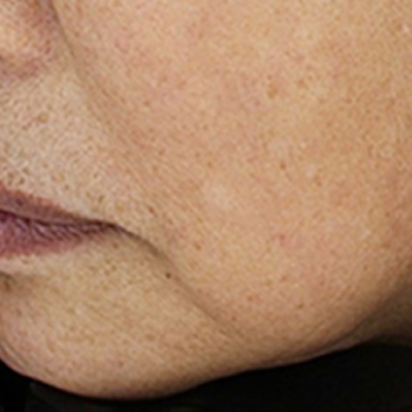 Before/After image 2