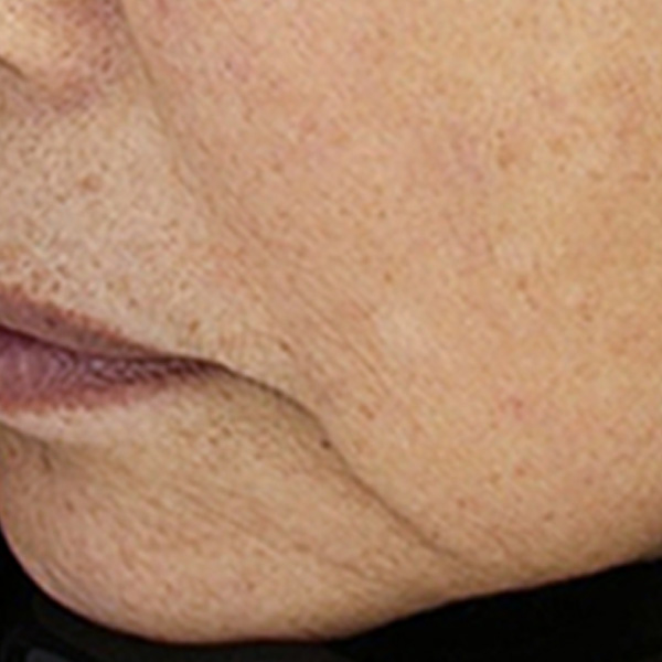 Before/After image 2