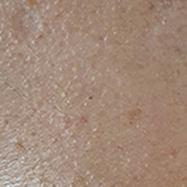 Before/After image 2