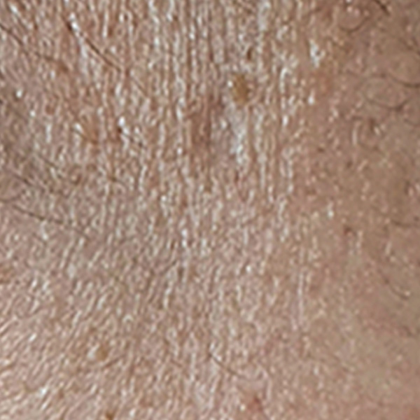 Before/After image 2