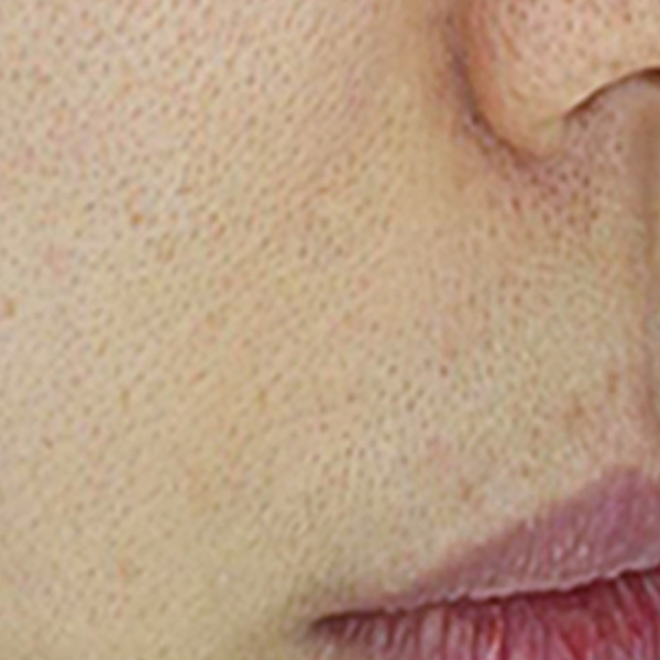 Before/After image 3