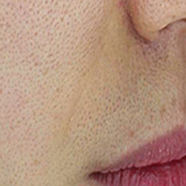 Before/After image 3