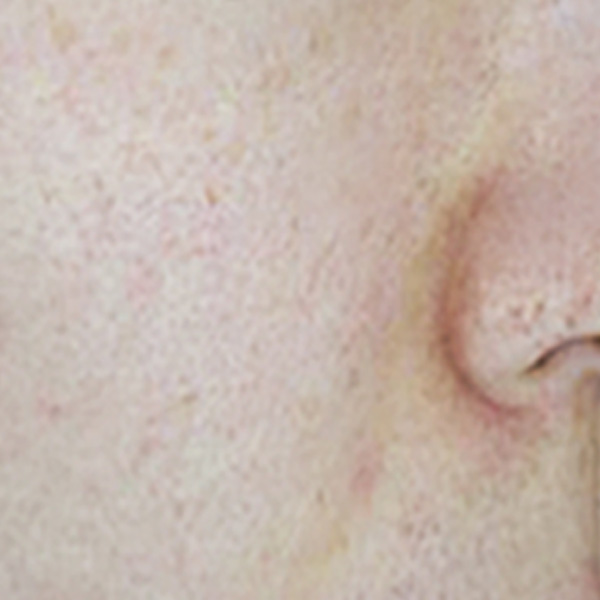 Before/After image 4