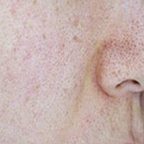 Before/After image 4