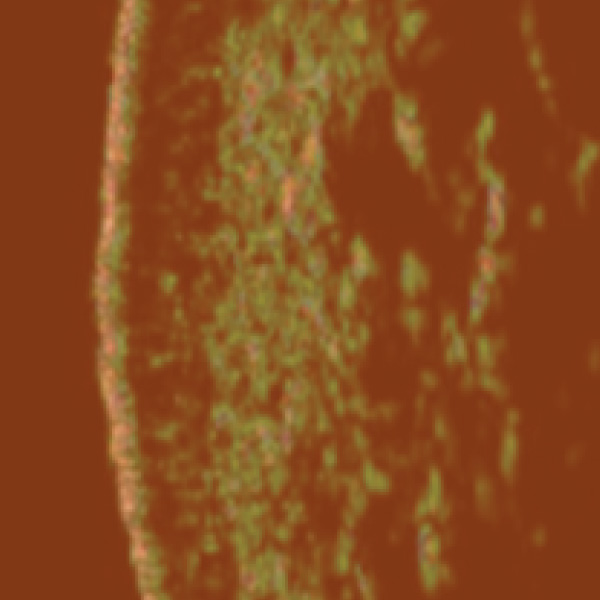 Microscope image after using Elastic Lab