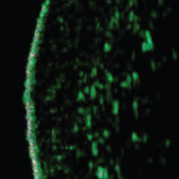 Microscope image before using Elastic Lab